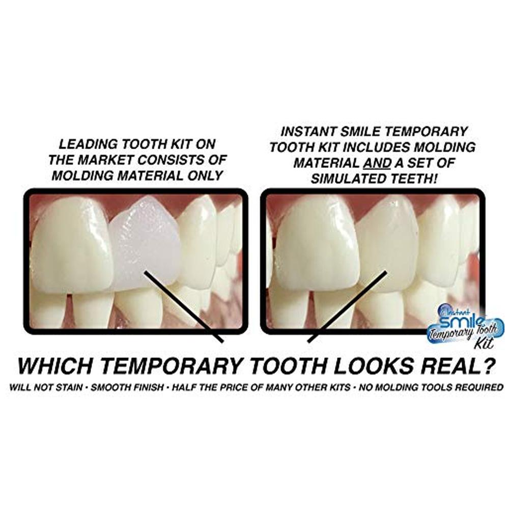 Instant Smile Temporary Tooth Kit