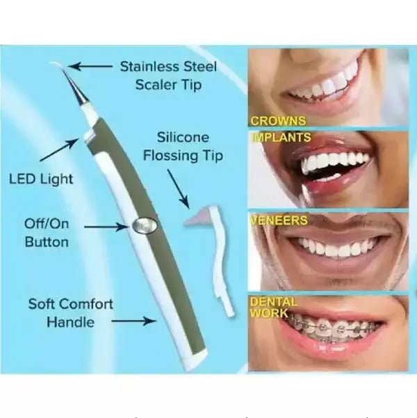 Sonic Pic Dental Cleaning System With Torch, Electric Calculus Teeth Cleaner Teeth Whitening *Free Shipping* - Techmanistan in Pakistan