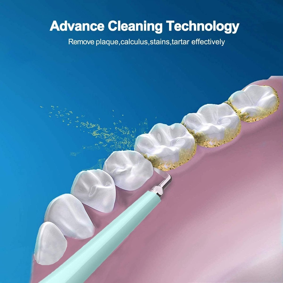 Teeth Cleaning Kit,5 - Working - Level Household Cleaner Brush Whitener Flossers USB Rechargeable Electric Food Scraper - Techmanistan in Pakistan