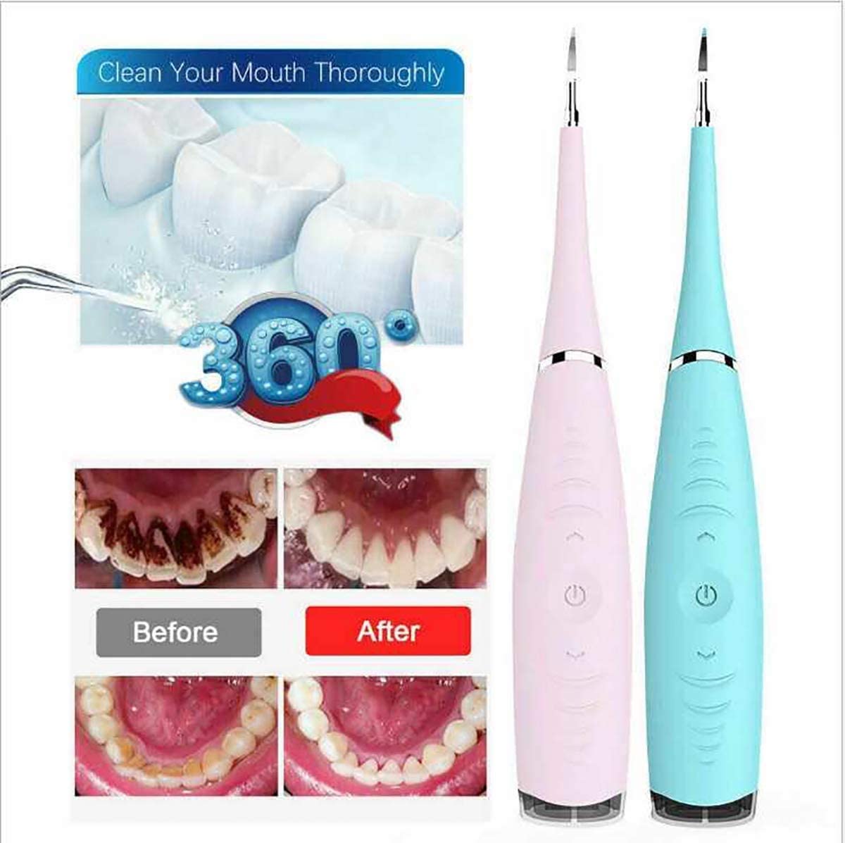 Teeth Cleaning Kit,5 - Working - Level Household Cleaner Brush Whitener Flossers USB Rechargeable Electric Food Scraper - Techmanistan in Pakistan